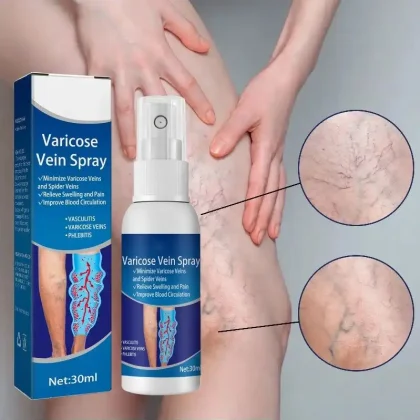 Varicose Vein Spray Relief Veins Minimize Varicose Veins and Spider Veins